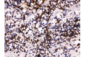 Anti- CD22 Picoband antibody, IHC(P) IHC(P): Human Tonsil Tissue (CD22 抗体  (C-Term))