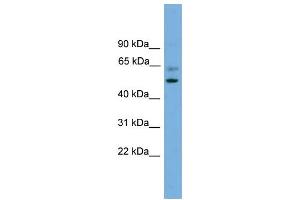 Western Blotting (WB) image for anti-Proteasome (Prosome, Macropain) 26S Subunit, Non-ATPase, 12 (PSMD12) (Middle Region) antibody (ABIN2787421)