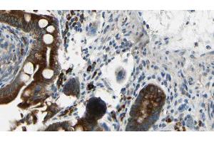ABIN6269178 at 1/100 staining Mouse intestine tissue by IHC-P. (GABA-RB 抗体)