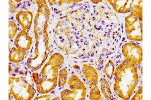 Immunohistochemistry of paraffin-embedded human kidney tissue using ABIN7170770 at dilution of 1:100 (CYP27A1 抗体  (AA 290-407))