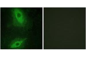Immunofluorescence analysis of HeLa cells, using TNFSF15 Antibody. (TNFSF15 抗体  (AA 181-230))
