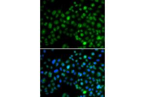 Immunofluorescence analysis of MCF-7 cells using NFIL3 antibody. (NFIL3 抗体)