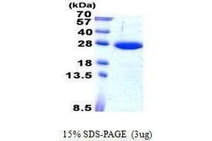 Figure annotation denotes ug of protein loaded and % gel used. (SAR1B 蛋白)