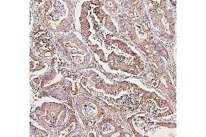 IHC analysis of ALDOA using anti-ALDOA antibody (ABIN7601907). (ALDOA 抗体  (AA 50-364))