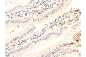 ABIN6267072 at 1/100 staining rat intestinal tissue sections by IHC-P.