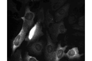 Cyclin B1 staining of U-2 OS (ATCC HTB-96) cells. (Cyclin B1 抗体  (AA 1-21))