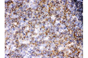 Anti- Lck Picoband antibody, IHC(P) IHC(P): Human Tonsil Tissue (LCK 抗体  (C-Term))