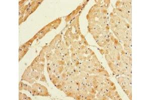 Immunohistochemistry of paraffin-embedded human heart tissue using ABIN7158825 at dilution of 1:100 (Lysozyme-Like 1 抗体  (AA 1-194))
