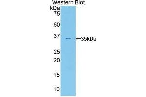 Western Blotting (WB) image for anti-Ectonucleotide Pyrophosphatase/phosphodiesterase 2 (ENPP2) (AA 637-905) antibody (ABIN1858722) (ENPP2 抗体  (AA 637-905))