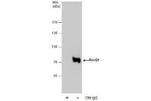 IP Image Immunoprecipitation of RecQ1 protein from HeLa whole cell extracts using 5 μg of RecQ1 antibody [C1C3], Western blot analysis was performed using RecQ1 antibody [C1C3], EasyBlot anti-Rabbit IgG  was used as a secondary reagent.