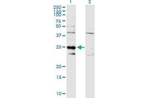 Western Blot analysis of C1QBP expression in transfected 293T cell line by C1QBP MaxPab polyclonal antibody. (C1QBP 抗体  (AA 1-282))