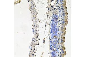 Immunohistochemistry of paraffin-embedded mouse lung using NDUFA6 antibody.