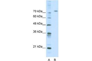 WB Suggested Anti-AFM Antibody Titration:  0. (Afamin 抗体  (Middle Region))