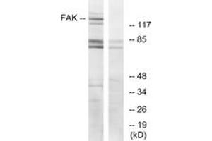 Western blot analysis of extracts from HeLa cells, treated with EGF, using FAK (Ab-925) Antibody. (FAK 抗体  (AA 892-941))