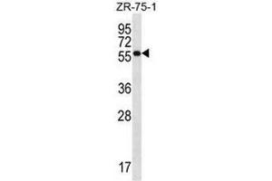 NR1D2 Antibody (Center) western blot analysis in ZR-75-1 cell line lysates (35µg/lane). (NR1D2 抗体  (Middle Region))