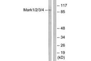 Western blot analysis of extracts from COS7 cells, using MARK1/2/3/4 (Ab-215) Antibody. (MARK1/2/3/4 抗体  (AA 181-230))