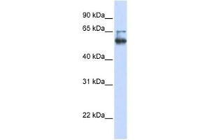 LENG4 antibody used at 1 ug/ml to detect target protein. (MBOAT7 抗体  (C-Term))
