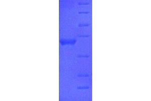 SDS-PAGE (SDS) image for Apolipoprotein A-I (APOA1) (AA 25-265), (full length) protein (His tag) (ABIN7478905)