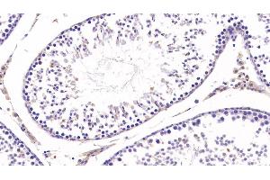 Immunohistochemistry (IHC) image for anti-Collagen, Type III, alpha 1 (COL3A1) (AA 1171-1435) antibody (ABIN7427603)