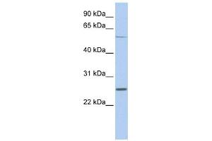 Western Blotting (WB) image for anti-Sodium Channel, Voltage-Gated, Type I, beta (SCN1B) (Middle Region) antibody (ABIN633779)
