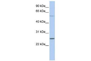 SCN1B antibody used at 1 ug/ml to detect target protein. (SCN1B 抗体  (Middle Region))