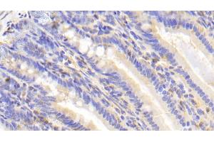 Immunohistochemistry (IHC) image for anti-Carcinoembryonic Antigen-Related Cell Adhesion Molecule 1 (CEACAM1) (AA 35-143) antibody (ABIN7436942)