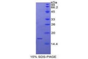 SDS-PAGE of Protein Standard from the Kit (Highly purified E. (Caspase 9 ELISA 试剂盒)