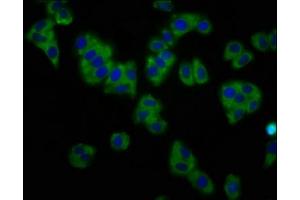 Immunofluorescence staining of HepG2 cells with ABIN7163940 at 1:133, counter-stained with DAPI. (KCNT1 抗体  (AA 1026-1230))