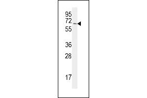 The anti-UBA2 C-term  Antibody (ABIN387913 and ABIN2844315) is used in Western blot to detect UBA2 in Jurkat lysate. (UBA2 抗体  (C-Term))