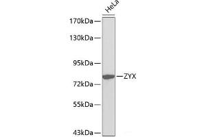 Western blot analysis of extracts of HeLa cells using ZYX Polyclonal Antibody. (ZYX 抗体)