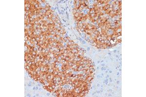 Immunohistochemistry (IHC) image for anti-Receptor-Interacting serine-threonine Kinase 3 (RIPK3) (AA 1-120) antibody (ABIN6146964)