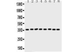 Western Blotting (WB) image for anti-Annexin A5 (ANXA5) (AA 2-320) antibody (ABIN3043502) (Annexin V 抗体  (AA 2-320))