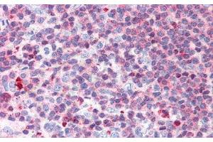 Detection of LTb in Human Spleen Tissue using Polyclonal Antibody to Lymphotoxin Beta (LTb) (LTB 抗体  (AA 58-304))