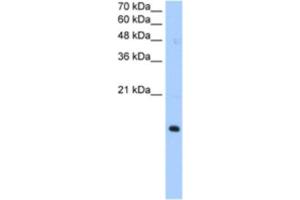 Western Blotting (WB) image for anti-Paired Immunoglobin-Like Type 2 Receptor alpha (PILRA) antibody (ABIN2463032) (PILRA 抗体)