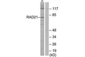 Western blot analysis of extracts from Jurkat cells, using RAD21 Antibody. (RAD21 抗体  (AA 521-570))