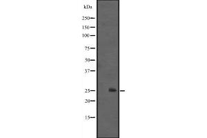Western blot analysis of IL1F6 expression in HEK293 cells ,The lane on the left is treated with the antigen-specific peptide. (IL36A/IL1F6 抗体  (Internal Region))