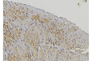 Immunohistochemistry (IHC) image for anti-Cytochrome P450, Family 17, Subfamily A, Polypeptide 1 (CYP17A1) (Internal Region) antibody (ABIN6258050)