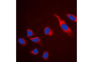 Immunofluorescent analysis of Claudin 5 staining in HeLa cells. (Claudin 5 抗体  (C-Term))