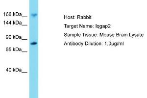 Host: Rabbit Target Name: IQGAP2 Sample Tissue: Mouse Brain Antibody Dilution: 1ug/ml (IQGAP2 抗体  (C-Term))