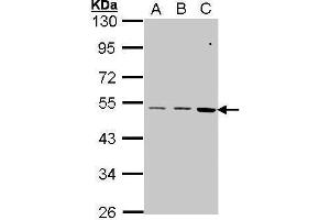 WB Image Sample (30 ug of whole cell lysate) A: A431 , B: H1299 C: Hela 10% SDS PAGE antibody diluted at 1:1000 (CCKBR 抗体  (C-Term))