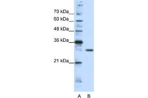 WB Suggested Anti-GSCL Antibody Titration:  1. (GSC2 抗体  (C-Term))