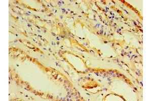 Immunohistochemistry of paraffin-embedded human kidney tissue using ABIN7143455 at dilution of 1:100 (ARF6 抗体  (AA 1-175))