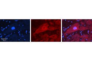 Rabbit Anti-IRF6 Antibody   Formalin Fixed Paraffin Embedded Tissue: Human heart Tissue Observed Staining: Cytoplasmic, nucleus Primary Antibody Concentration: N/A Other Working Concentrations: 1:600 Secondary Antibody: Donkey anti-Rabbit-Cy3 Secondary Antibody Concentration: 1:200 Magnification: 20X Exposure Time: 0. (IRF6 抗体  (Middle Region))