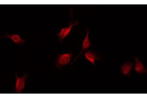 ABIN6267608 staining NIH-3T3 by IF/ICC. (FAK 抗体  (pTyr861))