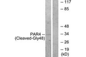 Western blot analysis of extracts from NIH-3T3 cells, treated with etoposide 25uM 1h, using PAR4 (Cleaved-Gly48) Antibody. (F2RL3 抗体  (Cleaved-Gly48))