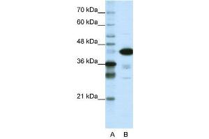 WB Suggested Anti-TARDBP  Antibody Titration: 1. (TARDBP 抗体  (N-Term))