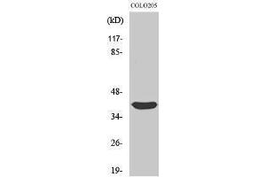 Western Blotting (WB) image for anti-Siah E3 Ubiquitin Protein Ligase 2 (SIAH2) (C-Term) antibody (ABIN3177413) (SIAH2 抗体  (C-Term))