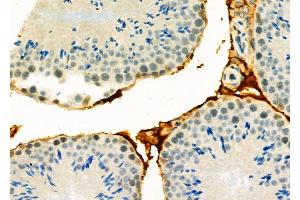 ABIN6265680 and ABIN6278645 at 1/100 staining Mouse testis tissue by IHC-P. (TP53INP1 抗体  (Internal Region))