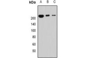 Western blot analysis of Periplakin expression in MCF7 (A), mouse lung (B), mouse heart (C) whole cell lysates. (PPL 抗体)