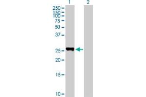 Western Blot analysis of PLEKHM1P expression in transfected 293T cell line by PLEKHM1P MaxPab polyclonal antibody. (PLEKHM1P 抗体  (AA 1-237))
